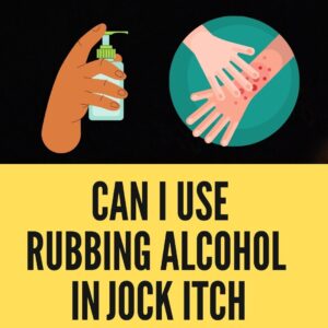 Does Rubbing Alcohol Cure Jock Itch and Athlete’s Foot?